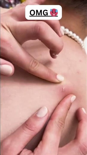 Wait for the pop 🤢