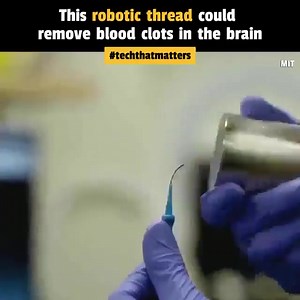 Engineers at MIT have created a smart robotic thread to treat brain blockages like aneurysms and strokes. This tiny thread moves precisely through blood vessels in the brain. Controlled by magnets, the robotic thread could assist doctors in treating blockages within the crucial first 90 minutes, preventing long-term damage. What's remarkable is that it might reduce the need for surgery and limit radiation exposure, making brain procedures more accessible for both patients and doctors. The roboti