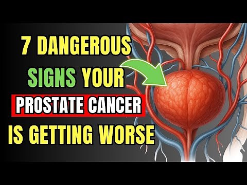 7 Critical Early Signs of Prostate Cancer You Need to Know Now!