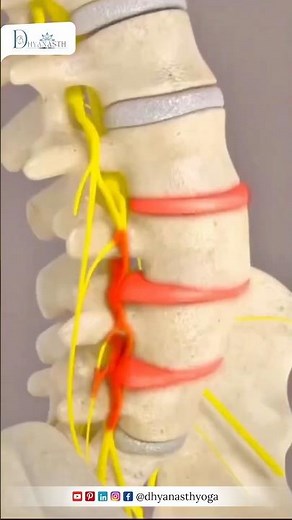 Back Pain Relief with Yoga | Reduce Lower Back Pain Naturally | Dhyanasth Yoga