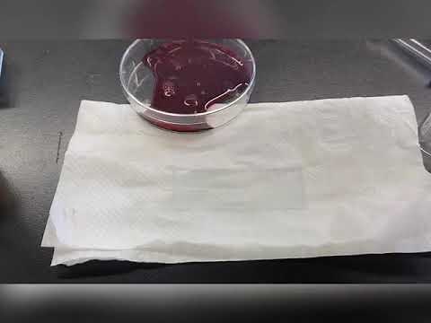 【高校生物】ギムザ染色液と血球