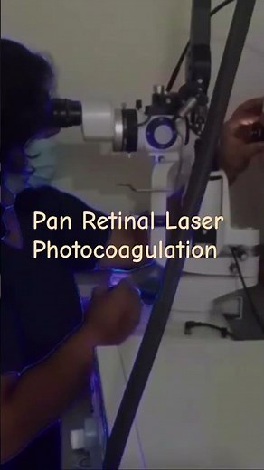 Retinal laser for diabetic retinopathy/ Panretinal Laser Photocoagulation. #retinalaser