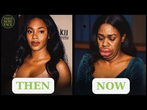 STOP Changing Your RACE with Surgery Before You Watch This | Plastic Surgery Fails