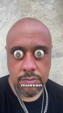 What’s wrong with his eyes? #biology #medicine