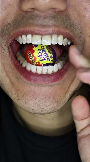 ASMR | Mini Cadbury Creme Egg 🍫 #DoctorTristanPeh #ASMR