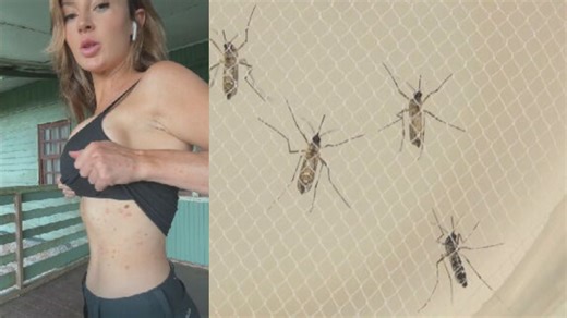 ‘World’s Hottest Scientist’ Speaks Out About Battle With Dengue Fever