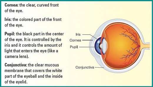 Explains Keratitis, an inflammation of the cornea - Prevent Blindness