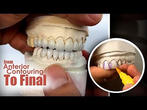 Step-By-Step From Anterior Contouring to Final