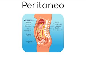 Peritonite acuta: sintomi, pericoli e cura