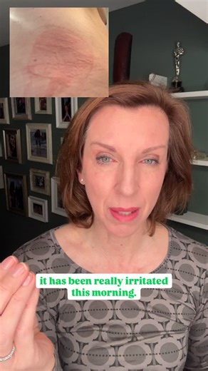 Dr Louise Newson on Instagram: "Absorption of estradiol from patches and gels through our skin can really vary. Our skin type, thickness and temperature can affect amount of absorption of estradiol through our skin. Sometimes my estradiol patches stick really well and my skin underneath looks normal when I remove the patches. Other days they don’t stick well and my skin underneath where the patch was sticking looks red and irritated. We prescribe different doses of estradiol so women have adequa