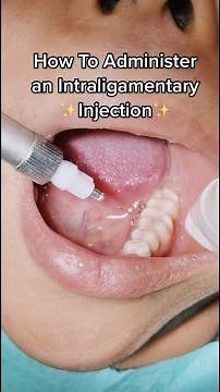 Highlighting Dental Anesthetic: Intraligamentary Injection | In Office to Hands On Dental Training
