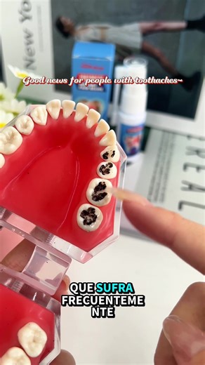 #titok #teeth #toothpaste #tiktokshop