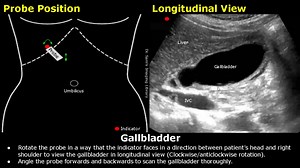 Abdominal, Gynecological & Obstetric Ultrasound Probe Positioning | Transducer Placement USG Scan 0:00 - Liver Ultrasound Probe Positioning 7:50 - Gallbladder Ultrasound Probe Positioning 12:35 - Pancreas Ultrasound Probe Positioning 15:35 - Kidney Ultrasound Probe Positioning 20:32 - Spleen Ultrasound Probe Positioning 22:10 - Appendix Ultrasound Probe Positioning 28:12 - Bladder Ultrasound Probe Positioning 29:27 - Uterus & Ovaries Ultrasound Probe Positioning 34:34 - Fetal Ultrasound Probe Po