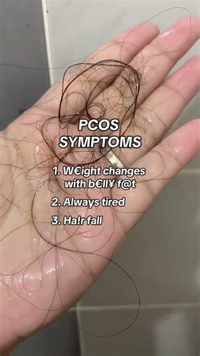 A breakdown of PCOS signs and symptoms.