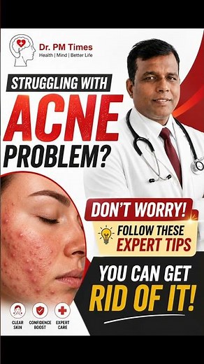 Struggling with Acne? Try These Simple Tips for Clearer Skin!