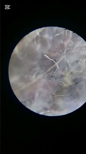Dust under a microscope #biology #microscope #science #dust