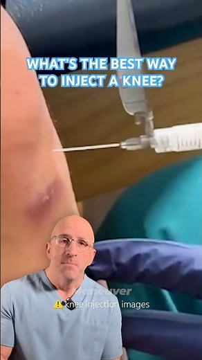 Best Knee Injection Technique For Pain Relief⁉️ #shorts