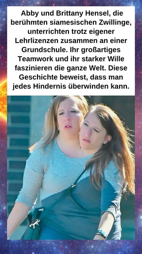 Zwei Körper, eine Seele: Der faszinierende Erfolg der siamesischen Zwillinge! 🎓👭
