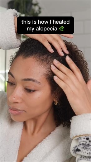 "𝗜 𝗹𝗶𝘁𝗲𝗿𝗮𝗹𝗹𝘆 𝘀𝗮𝘄 𝗿𝗲𝘀𝘂𝗹𝘁𝘀 𝗮𝗳𝘁𝗲𝗿 𝗼𝗻𝗲 𝘂𝘀𝗲!" 🍯 Houdini includes: ✨ Vegan & Organic formula 🍯 Suitable for all hair types 🩹 Prevents & heals hair loss ⭐ 150,000 happy customers Try it for 30 days! Love it or your money back ✨ Your solution to hair loss awaits you 👇 https://getgrows.com/products/batana | GetGrows