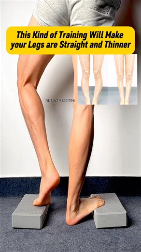 How to Correct Bow Legs in Exercises 💯 || Bow Legs Straight & Thin Stretches 🔥💥💪 #bowlegs #orthopedics #orthopedic #orthopedicsurgeon #orthopedicsurgery #surgery #ortopedicsurgeons #spine #physicaltherapy #orthop #surgeon #orthopedicdoctor #sports #medical #o #physiotherapy #wellness #doctor #orthopaedics #orthopaedic #ortho #injury #ortopedia #hospital #health #sportsmedicine #knee #bowleg #surgical #backpain ************************************************** Get Straight, Slender and Longe