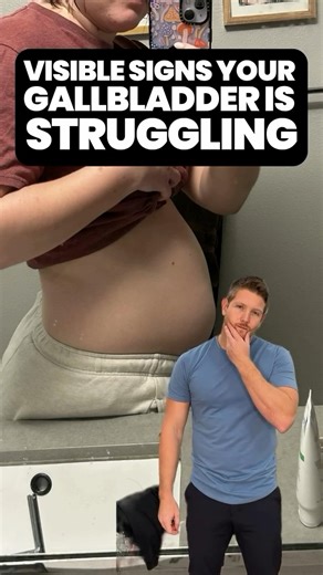 405K views · 830 reactions | 1.2 million gallbladder surgeries are performed every year in the United States… but are all of them necessary? There are ways to save our gallbladder. Comment “GET STARTED” if you have these symptoms. My virtual clinic is here to support you and save your gallbladder. Sound like you? | Dr. Jaban Moore | Facebook