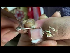 Step by Step Guide to Cutting and Cleaning Toenails, #nails