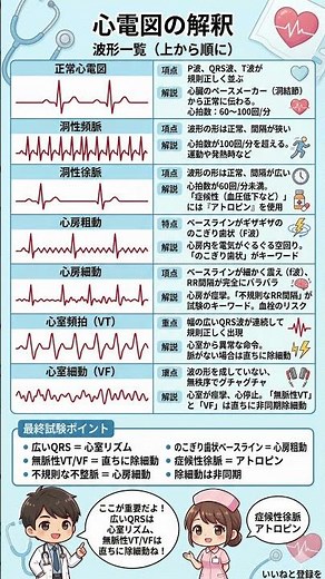 【心電図図解】不整脈の読み方完全攻略！「頻出波形」と緊急度判断の重要ポイント徹底解説