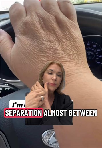 Hands Don’t Lie ✋✨ Give Them the Same Care as Your Face👩🏼‍🔬 Hands thin quickly and lose smoothness fast — here’s how to keep them looking refined and youthful: 💎 Diamond Peptide Spicule Exfoliating Peel Gently resurfaces the skin to smooth rough texture and soften the look of wrinkles by encouraging fresh, even-looking skin. 🧬 Copper Peptides Help support skin repair and improve the look of firmness and resilience over time. ☀️ SPF (non-negotiable) Hands are constantly exposed to UV, which 