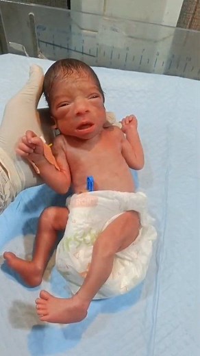 21K views · 330 reactions | #baby #birth #newbornbaby | Global Nursing Profession | Facebook