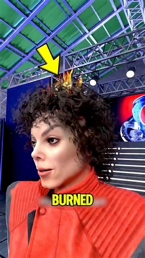 Michael Jackson's Hair Caught on Fire 😲🔥