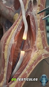 Como é feita a vasectomia? 🧬🔬 Veja, de forma anatômica #Anatomia #Medicina #Shorts# curiosidades