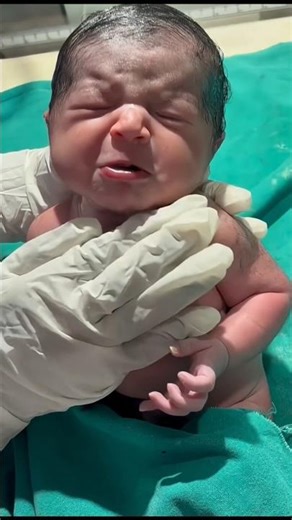 Painful Yet Beautiful Journey of Giving Birth to Twins👶💞 the Pure Magic #shorts #viral #motherhood