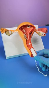 1.6M views · 3.1K reactions | Understanding Medical Procedures – A Simple Guide To How They Work! | 5-Minute Crafts Men | Facebook