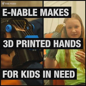 48K views · 304 reactions | Many kids born without fingers have to wait until they’ve stopped growing to get a prosthetic hand. But thanks to 3D printing, that’s changing. | The Feed SBS | Facebook
