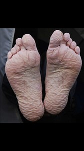 16K views · 393 reactions | Sleep With Socks On Or Off...