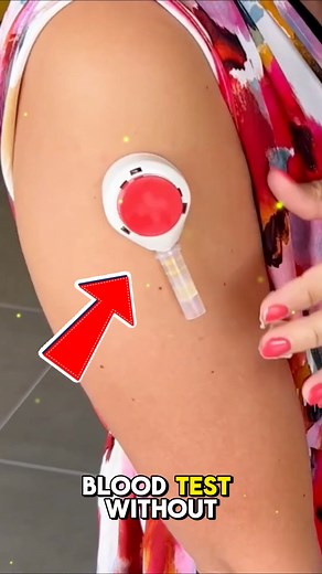 264K views · 1.9K reactions | Smart Blood Testing Made Easy Meet...