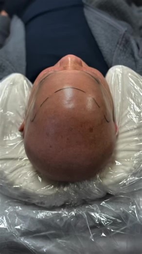 From barber to Bay Area SMP Master Trainer. This isn’t a filter — it’s skill, experience, and precision. Whether you’re looking to restore your hairline or learn a high-income skill, you’re in the right chair. 📍 San Lorenzo, CA 🎓 SMP Training | 🧑‍🦲 SMP Services Book your free consultation or discovery call 👇 www.ScalpMicropigmentationCA.com Free training guide in bio #SMPTrainer #ScalpMicropigmentation #HairLossSolution #SMPTraining #BayAreaSMP