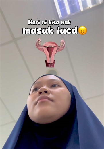 Panduan dan Kelebihan Penggunaan IUCD