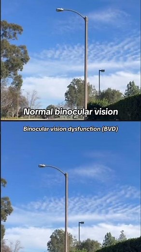 Have you ever paid attention to how each of your eyes perceives space? Fixate on a target
