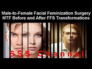 Before/After Male-to-Female Transgender Transformations Facial Feminization Surgery FFS SSS Channel