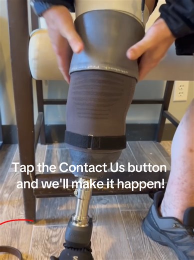 Ready to take your first step with a transtibial prosthesis? Tap the Contact Us button and we'll make it happen! The first step on a new prosthesis is life-changing🥹 When the bond is right– mobility and confidence grow🦾 👉Click the link in the bio to learn if a transtibial prosthesis is right for you. 💚Tap the Contact Us button to begin the journey toward your first step. #LimbLab #Prosthetics #CustomProsthetics #ProstheticLeg #TranstibialProsthesis AmputeeLife LifeAfterAmputation Prosthetics