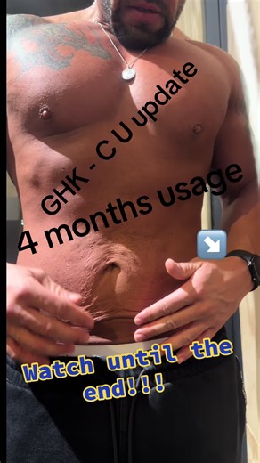 G H K - C u is mainly a regenerative and anti-aging peptide, with the strongest evidence for skin repair, hair support, and wound healing, rather than muscle growth or fat loss. This is for research purposes only. I’ve been using it for over 4 months now and I’m seeing some incredible results. I strongly recommend if you struggle with stretch marks loose skin. Doing some of your own research. Game changer 🙏🏽. #looseskin #bodypositivity #transformation #anxiety #confidence