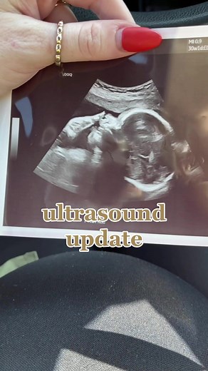30 Weeks Pregnant Ultrasound Update