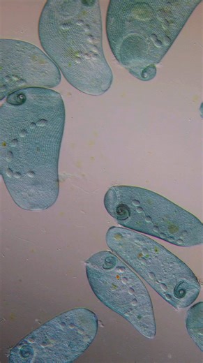 687K views · 11K reactions | 20 second of Stentor sp. the blue whale of the microworld  Hope you sre having a great sunday! #Science #microscopy #biology | Science into Images | Facebook