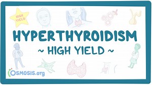 Hyperthyroidism: Pathology review: Video, Causes, & Meaning | Osmosis