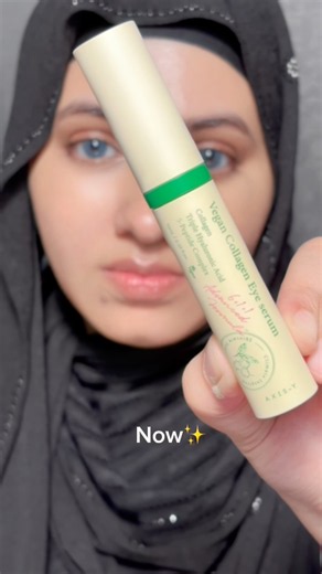 No Serum Will Fix Your Under Eyes? | Dark Circles & Under Eye Care #undereyebags #darkspotcorrector