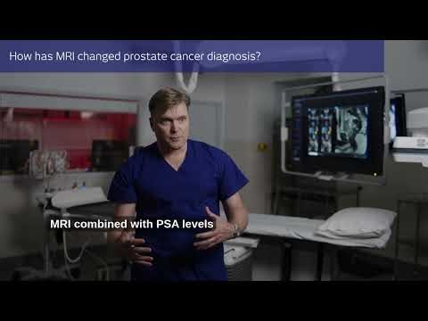 Leading edge prostate imaging at I-MED