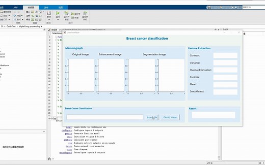 深度学习之使用Matlab乳腺癌分类检测系统(GUI界面)