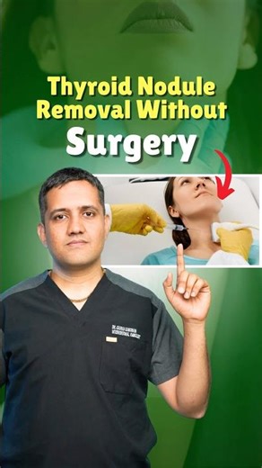 गले की गाँठ गायब बिना Operation? | Thyroid Nodule Treatment Without Surgery #thyroidtreatment