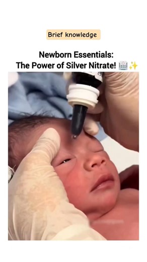 This Drop Protects a Baby’s Vision 👶👁️